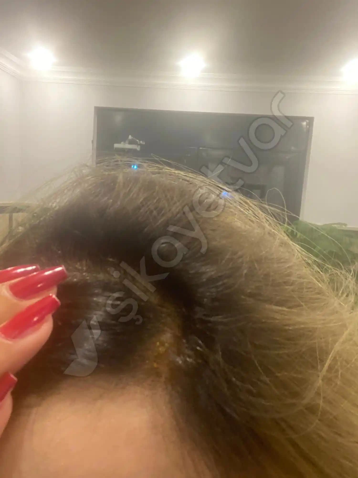 Saç Dökülmesi ve Saç Diplerindeki Ağrı Nedenleri ile Çözüm Yolları Rehberi