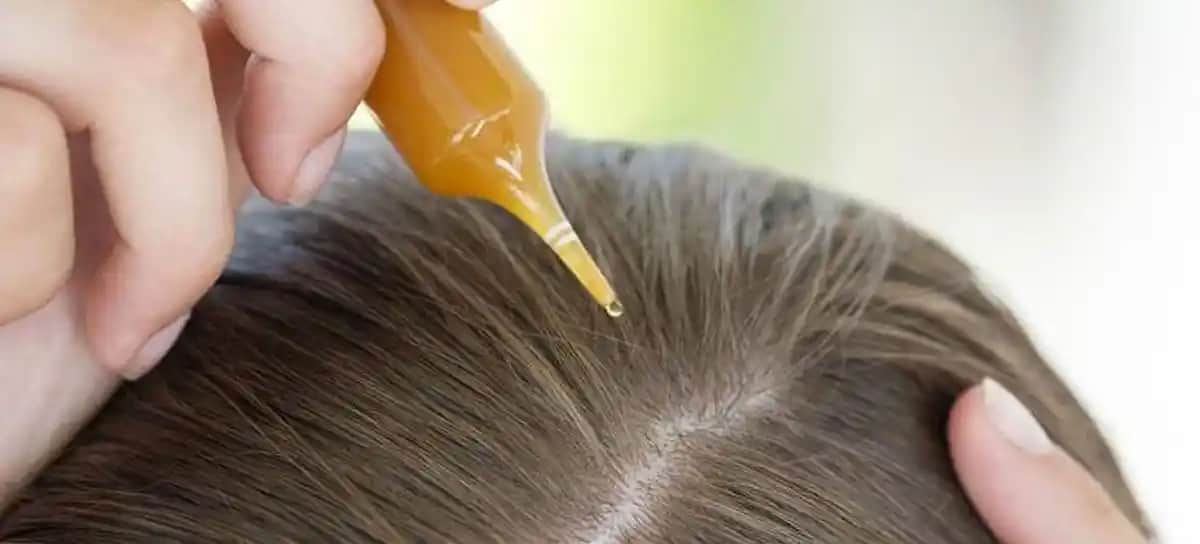 Saç Dökülmesine Karşı En Etkili Doğal Yağlar ve Kullanım Yöntemleri