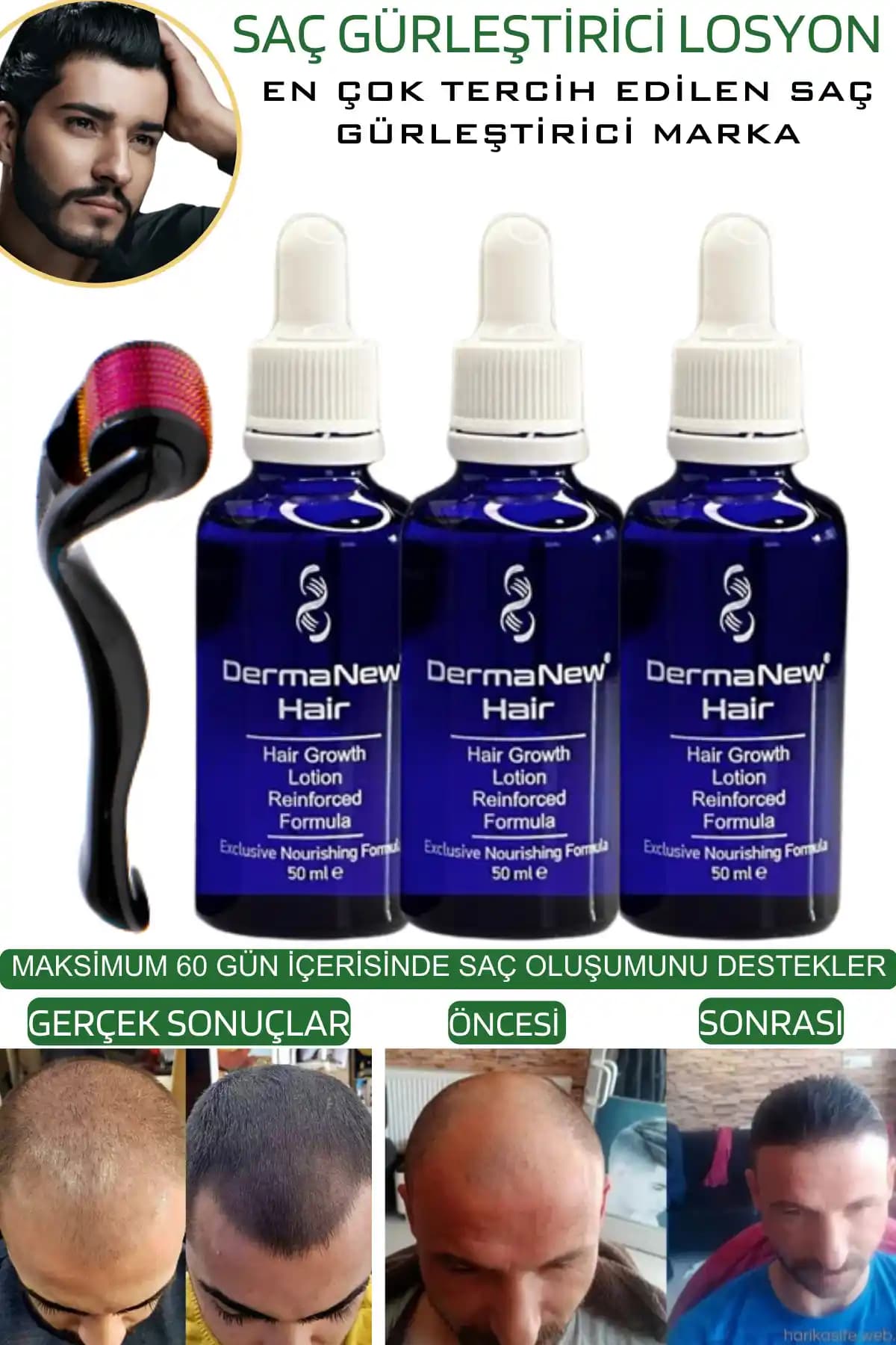 Saç Gürleştirici Ürünler Rehberi: Hacimli ve Sağlıklı Saçlar İçin En İyi Seçenekler