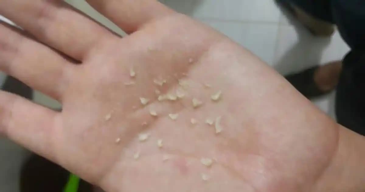 Saç Kaşıntısının Nedenleri ve Etkili Çözüm Yolları Hakkında Kapsamlı Bilgi