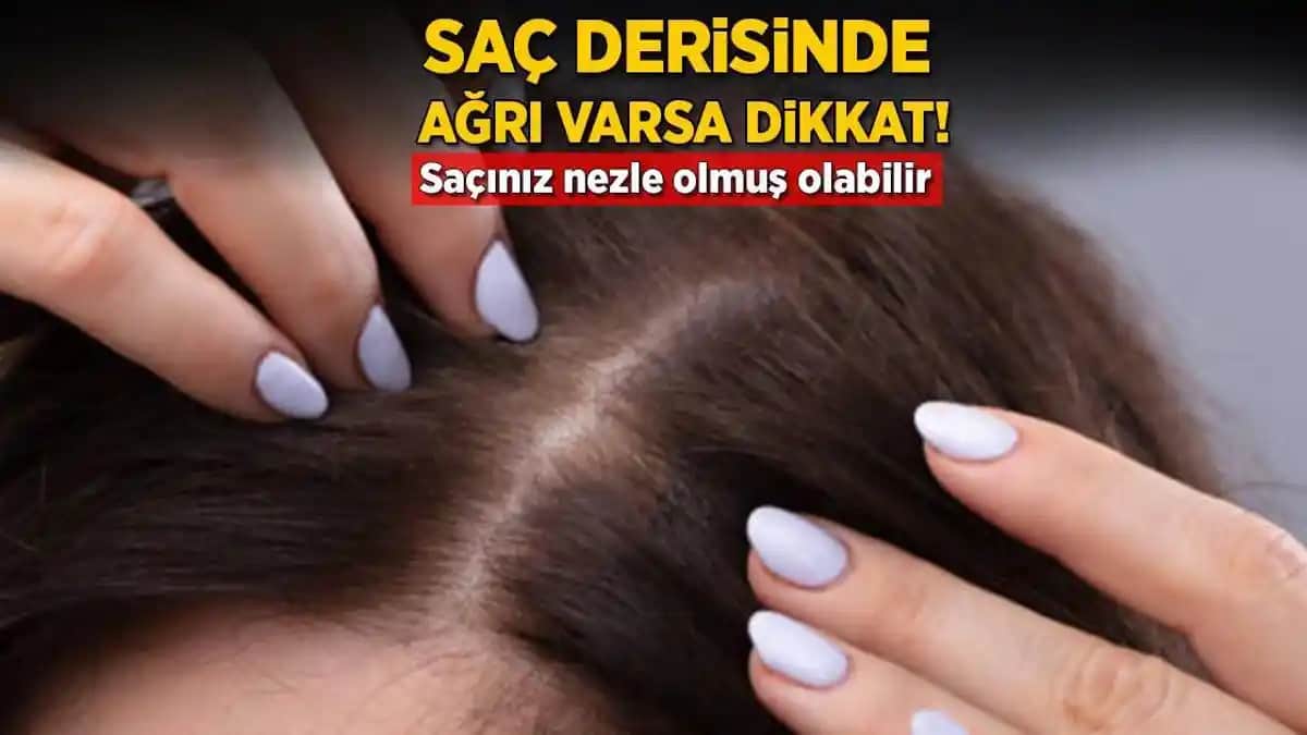 Saç Köklerindeki Ağrı Nedenleri ve Hafifletici Yöntemler Hakkında Detaylı Bilgi