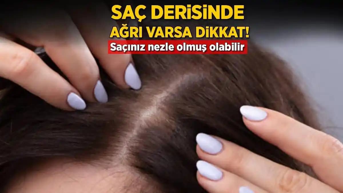 Saç Köklerindeki Ağrı Nedenleri ve Hafifletici Yöntemler Hakkında Detaylı Bilgi