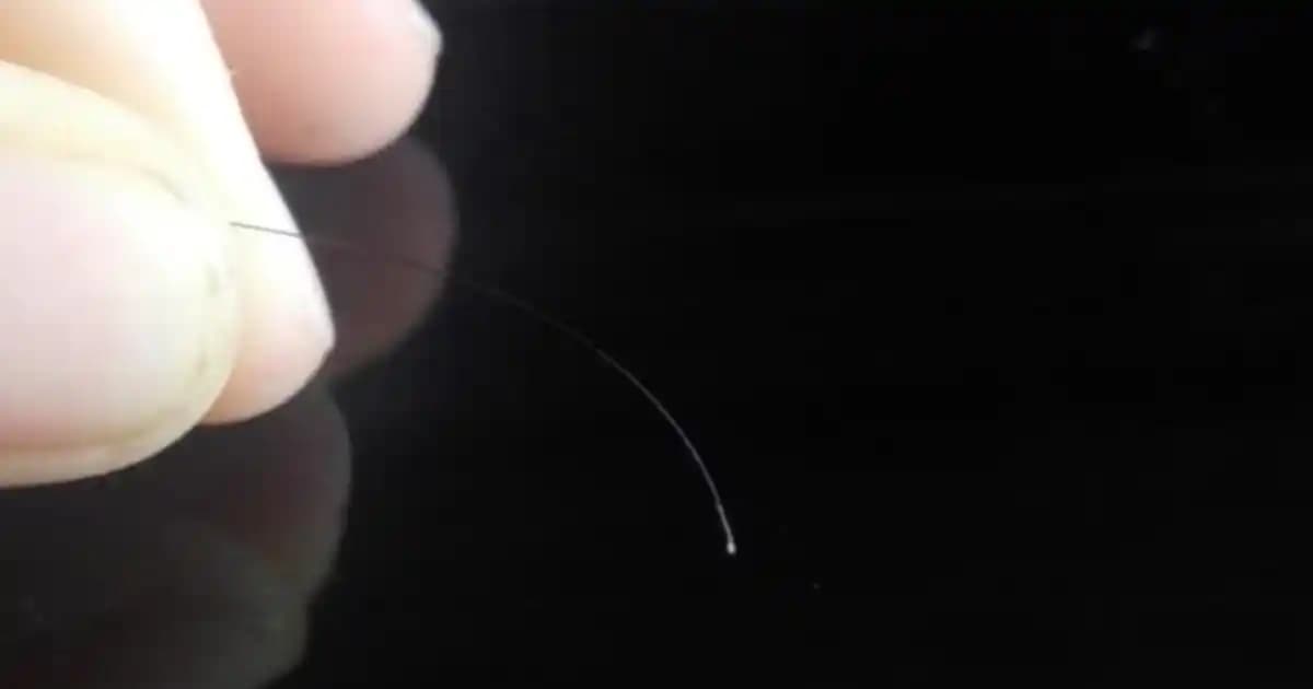 Saç Kökündeki Beyaz Şey Nedir ve Sağlıklı Saçlar İçin Bilmeniz Gerekenler