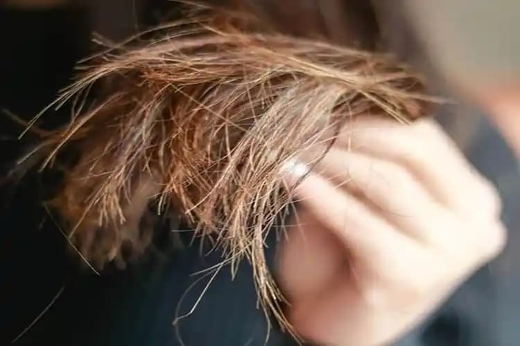 Saç Neden Kopar? Saç Sağlığını Korumak İçin Bilmeniz Gerekenler