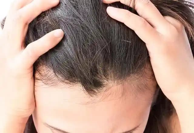 Saç Nezlesi Nedenleri ve Etkili Bakım Yöntemleri Hakkında Detaylı Bilgi