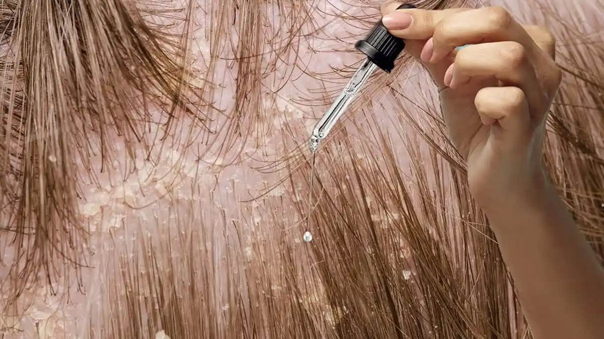 Saç Uzamasını Hızlandıran En Etkili Doğal Yağlar ve Kullanım İpuçları