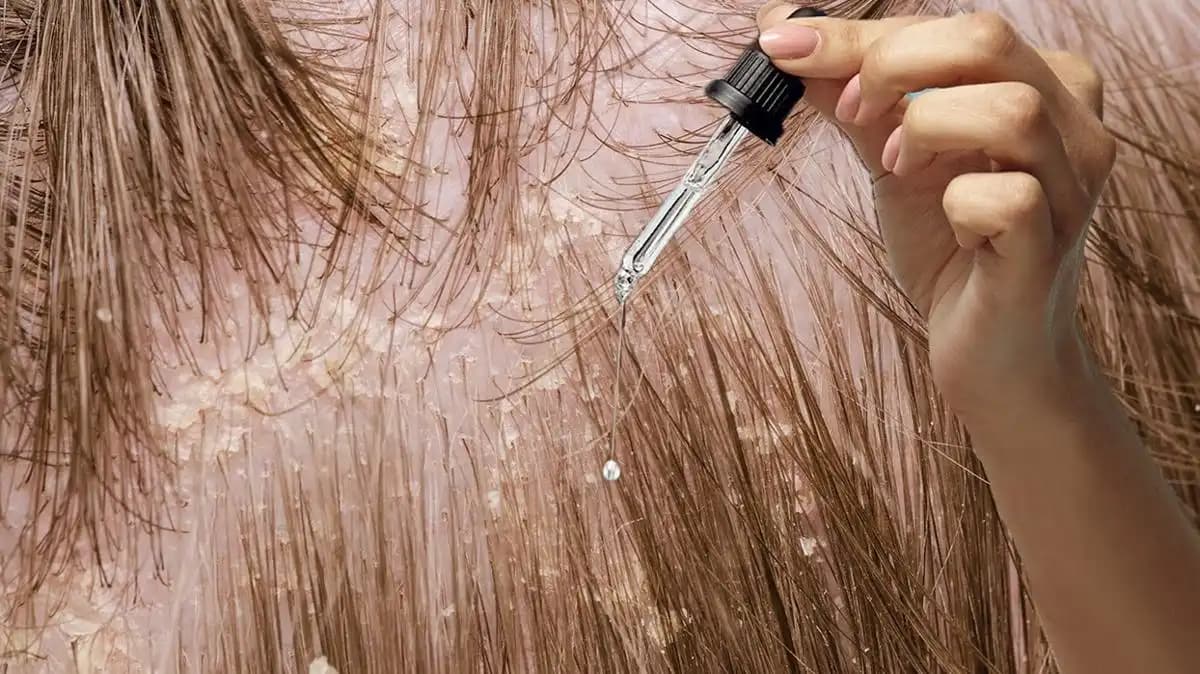 Saç Uzamasını Hızlandıran En Etkili Doğal Yağlar ve Kullanım İpuçları