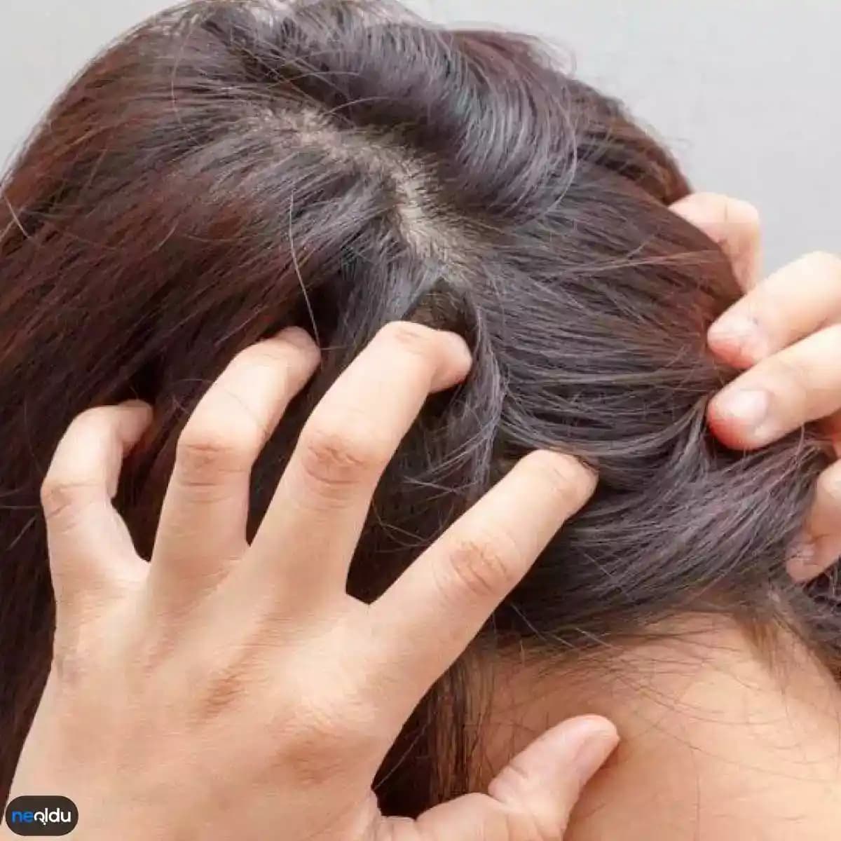 Saç Yağlanması ve Kaşıntı Nedenleri ile Çözüm Yolları Hakkında Detaylı Bilgi