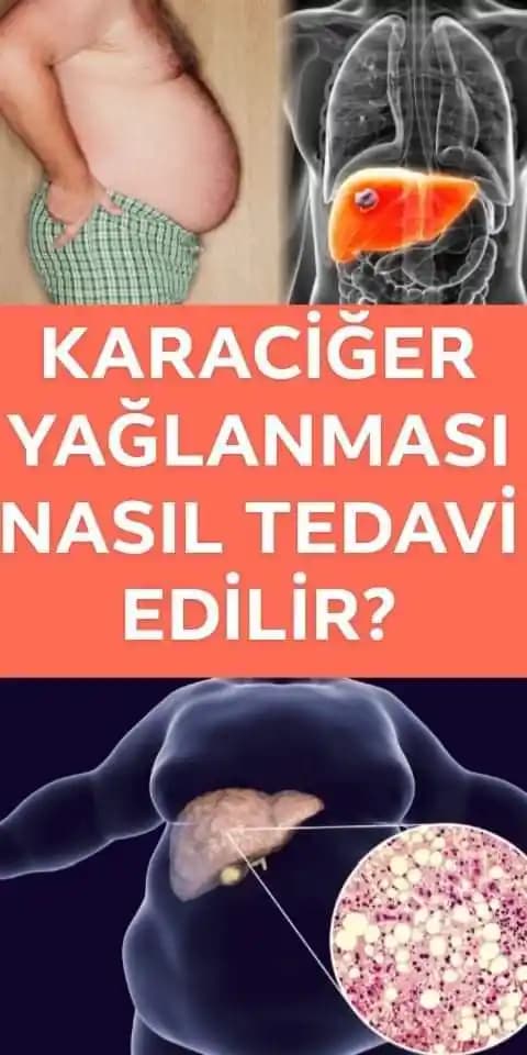 Saç Yağlanmasını Önlemenin Etkili Yolları ve Sağlıklı Saçlar İçin İpuçları