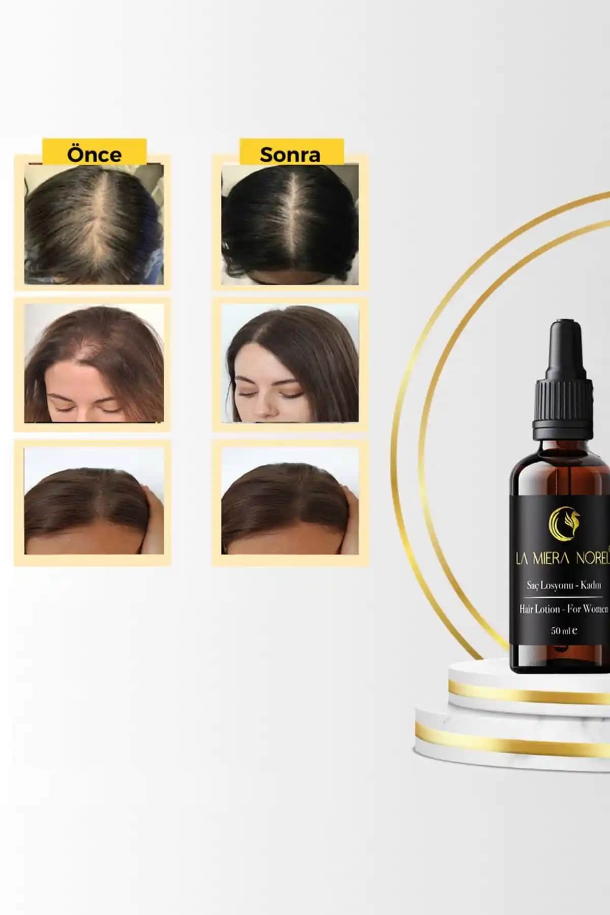 Saçı Güçlendiren Doğal ve Kimyasal Yöntemler: Etkili Bakım ve Beslenme İpuçları