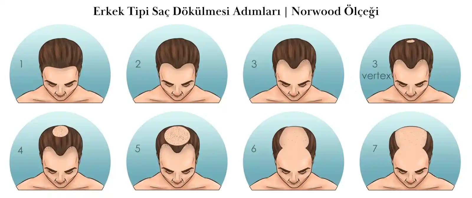 Saçın Pul Pul Dökülmesinin Nedenleri ve Etkili Çözüm Yolları Hakkında Detaylı Bilgi