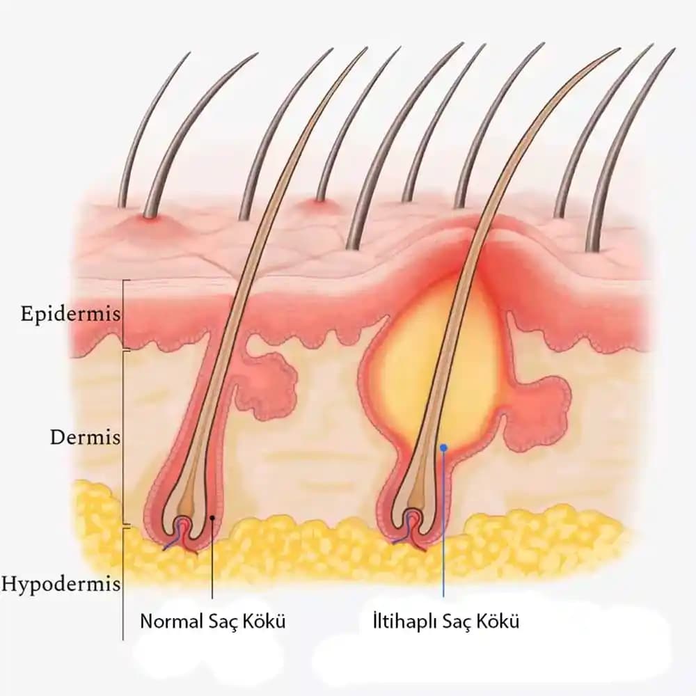 Saçın Temel Bileşenleri ve Sağlıklı Saç Bakımı Yöntemleri Hakkında Bilgi