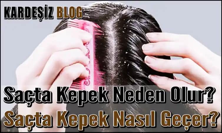 Saçta Çok Kepek Olmasının Nedenleri ve Etkili Çözüm Yolları Hakkında Kapsamlı Rehber