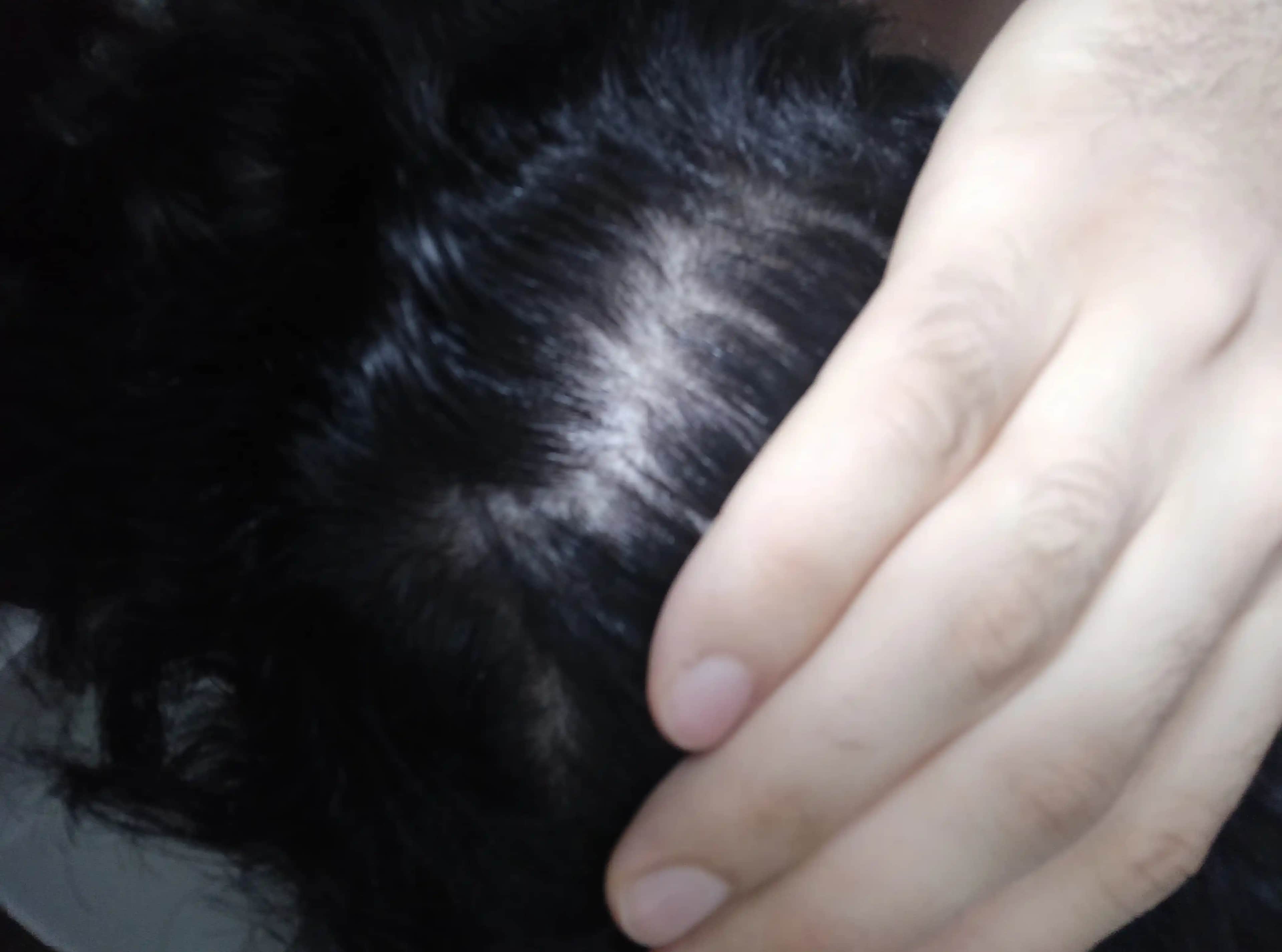 Saçta Kaşıntı ve Dökülmenin Nedenleri, Çözüm Yolları ve Doğal Yaklaşımlar