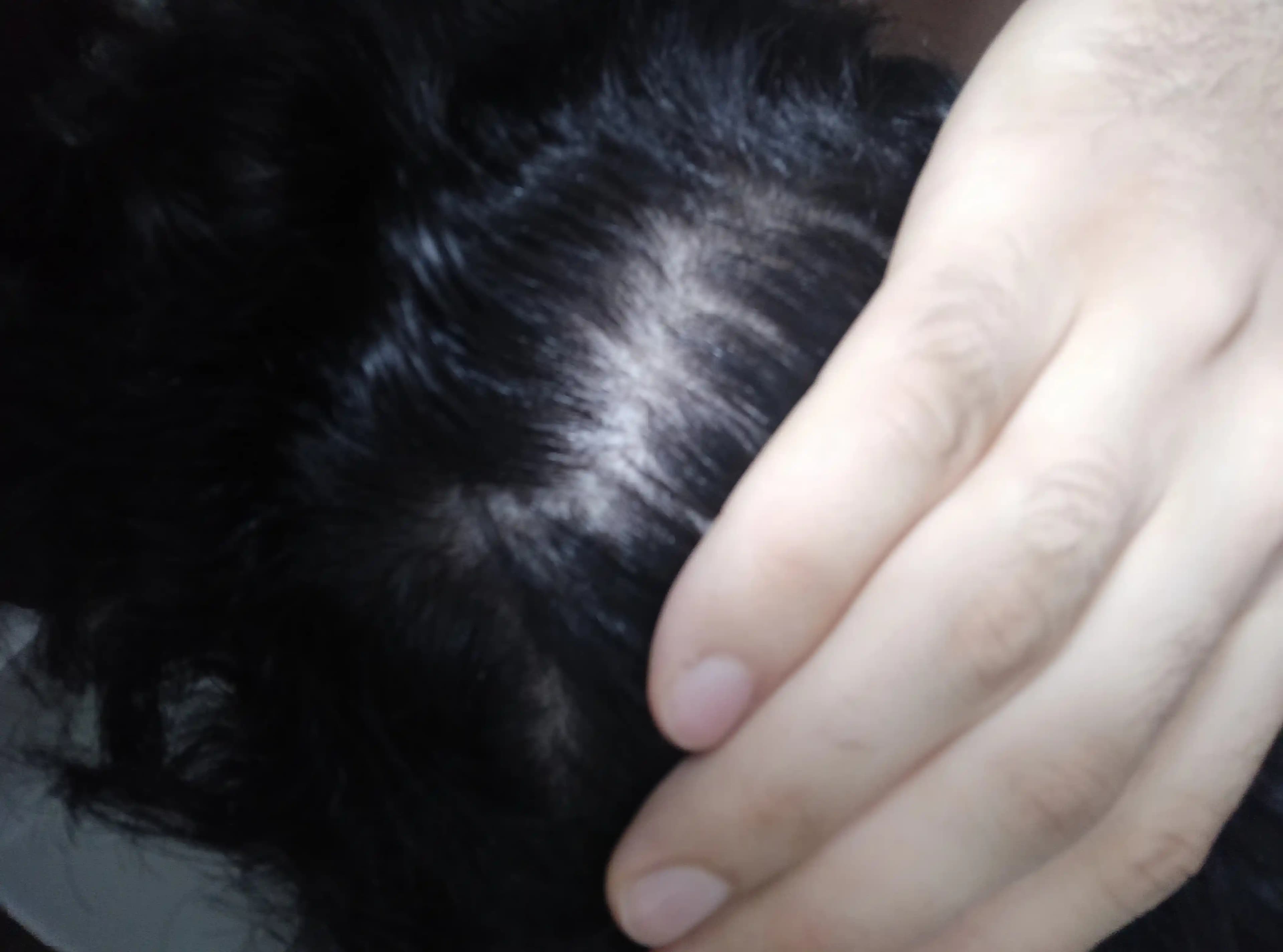 Saçta Kaşıntı ve Dökülmenin Nedenleri, Çözüm Yolları ve Doğal Yaklaşımlar