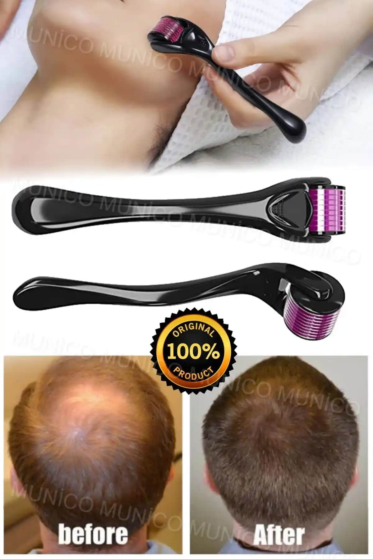 Sakal Çıkarıcı Roller Nedir ve Erkek Bakımında Nasıl Kullanılır