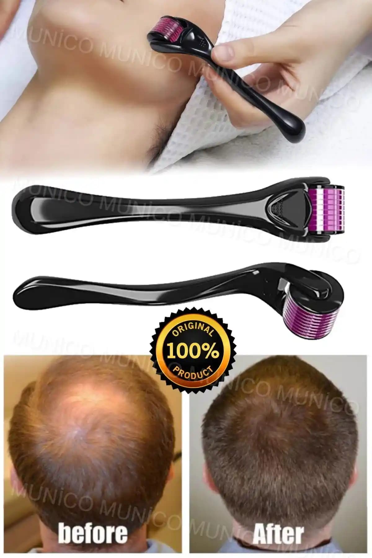 Sakal Çıkarıcı Roller Nedir ve Erkek Bakımında Nasıl Kullanılır