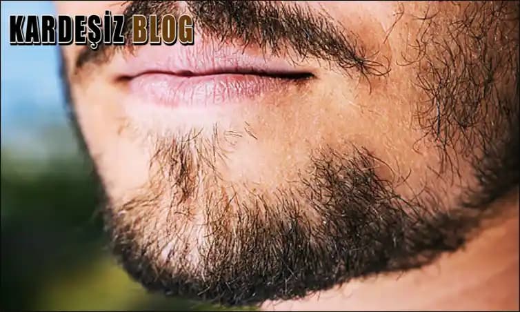 Sakal Mantarı Nedenleri Belirtileri ve Etkili Tedavi Yöntemleri Hakkında Detaylı Bilgi