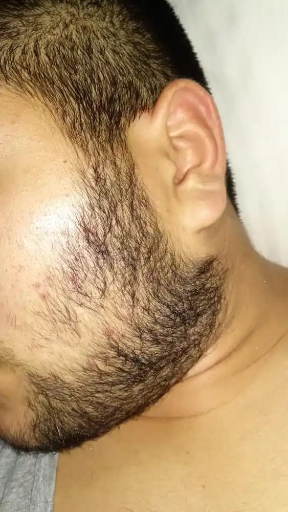 Sakalın Sertleşmesini Sağlayan Etkili Yöntemler ve Bakım İpuçları