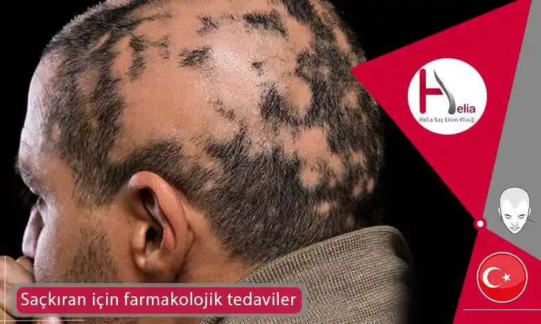 Sakalkıran Nedir Nasıl Önlenir ve Etkili Çözüm Yolları Hakkında Kapsamlı Bilgi