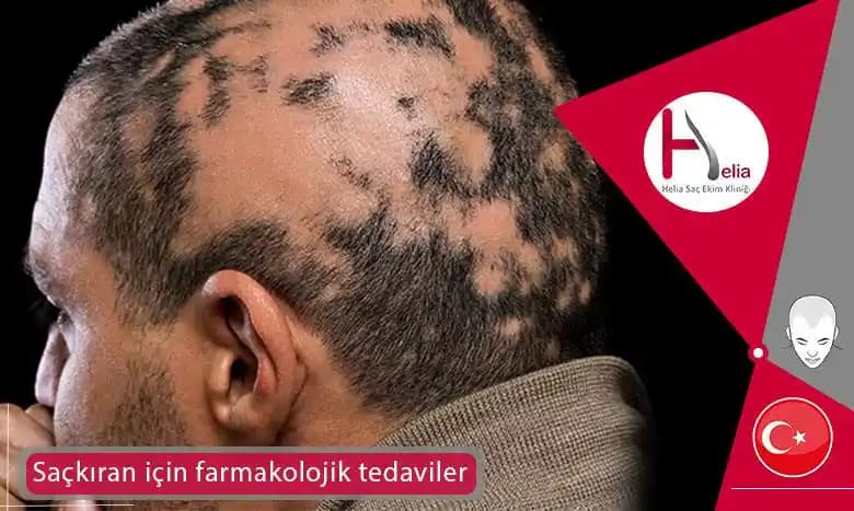 Sakalkıran Nedir Nasıl Önlenir ve Etkili Çözüm Yolları Hakkında Kapsamlı Bilgi