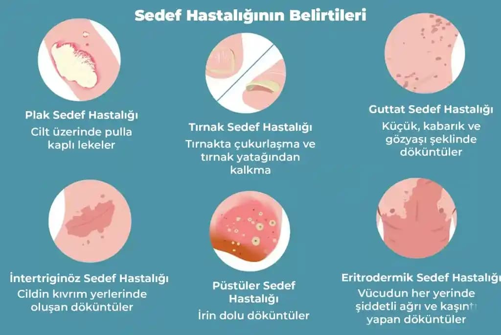 Sedef Hastalığı ve Yüz Bakımı: Kozmetik Yaklaşımlar ve Doğal Çözümler
