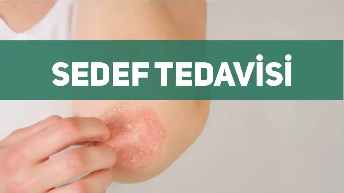 Sedef Hastalığında Güvenli ve Etkili Kozmetik Bakım Yöntemleri