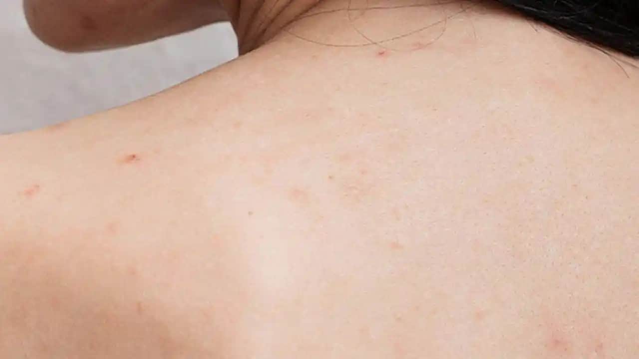 Sırttaki Sivilcelere Etkili Çözüm Yolları ve Cilt Bakımı Tavsiyeleri