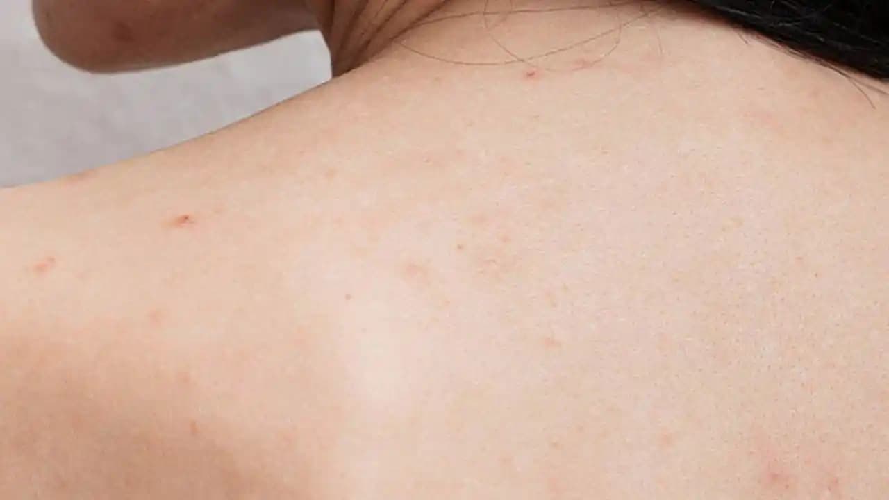 Sırttaki Sivilcelere Etkili Çözüm Yolları ve Cilt Bakımı Tavsiyeleri