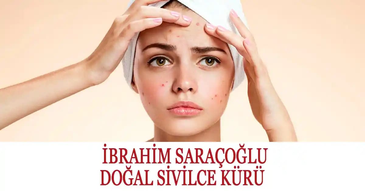 Sivilce Kürü ve Doğal Çözümlerle Cilt Sağlığını Destekleme Rehberi