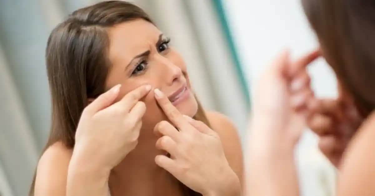 Sivilce Oluşumunu Engelleyen Besinler ve Sağlıklı Cilt İçin Doğru Beslenme İpuçları