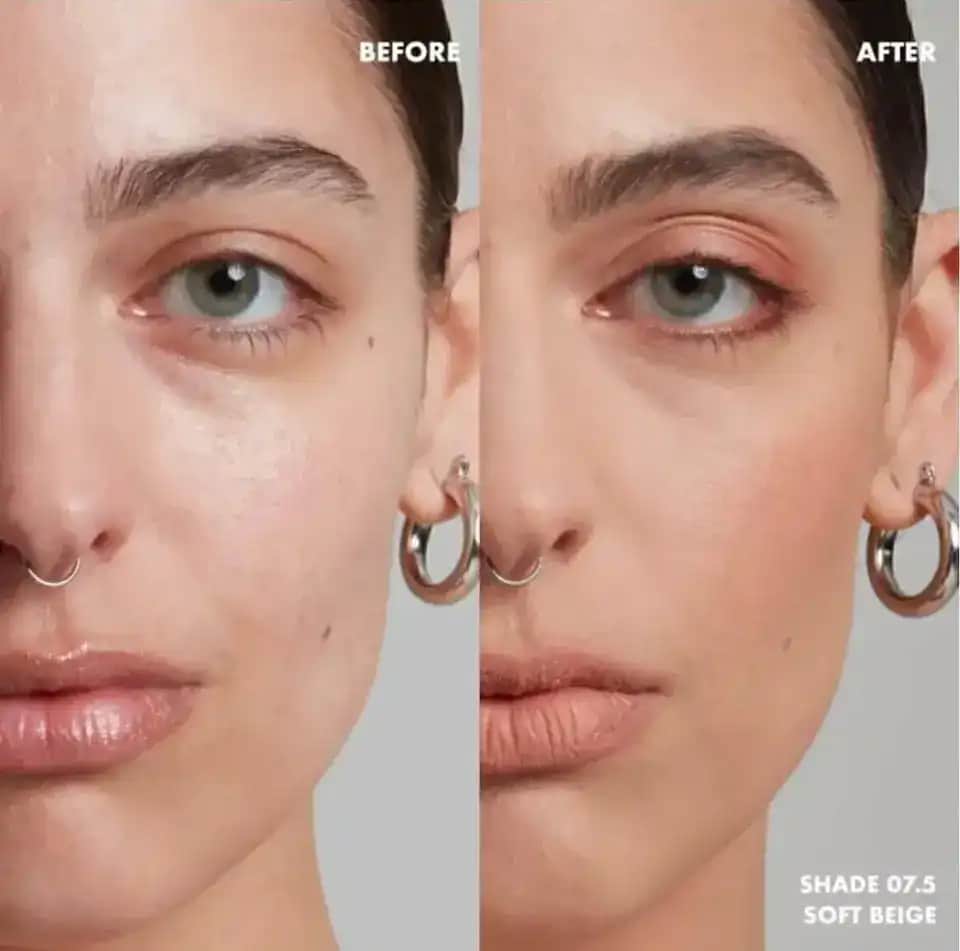 Sivilceli Ciltler İçin Doğru Fondöten Seçimi ve Uygulama İpuçları