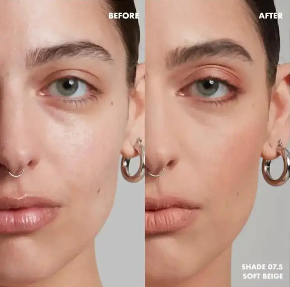 Sivilceli Ciltler İçin Doğru Fondöten Seçimi ve Uygulama İpuçları