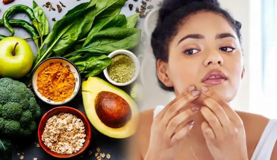 Sivilceyi Azaltan ve Tetikleyen Yiyecekler: Sağlıklı Bir Cilt İçin Beslenme Rehberi