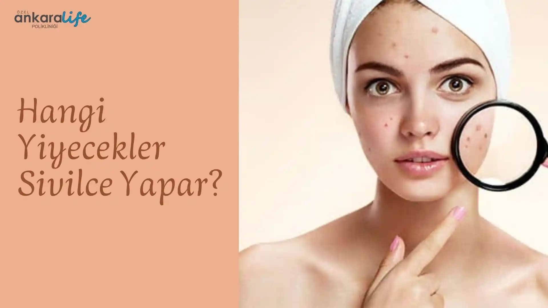 Sivilceyi Azaltan Yiyecekler ve Sağlıklı Bir Cilt İçin Beslenme Rehberi