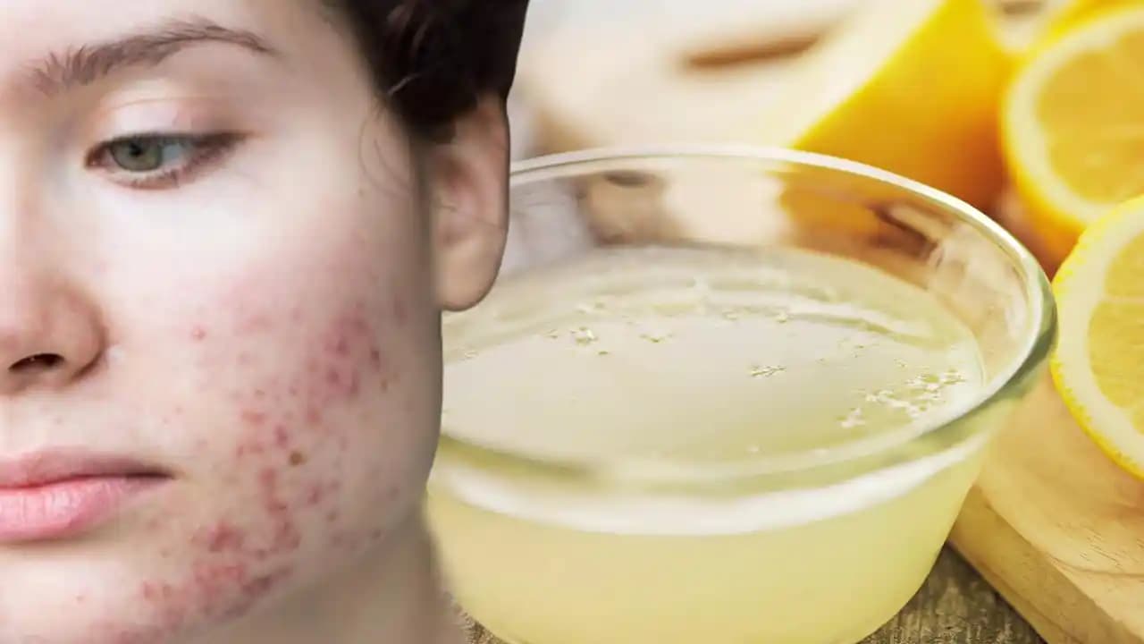 Sivilceyi Geçiren Etkili Yöntemler ve Cilt Bakımı İpuçları