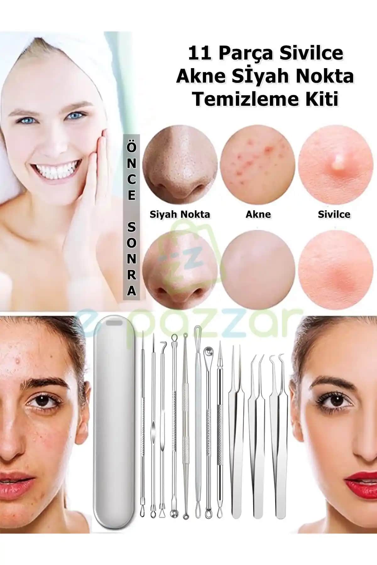 Siyah Noktalı Sivilcelerle Mücadele Yöntemleri ve Cilt Bakım İpuçları