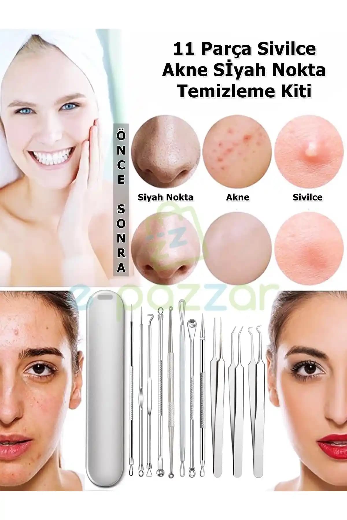 Siyah Noktalı Sivilcelerle Mücadele Yöntemleri ve Cilt Bakım İpuçları