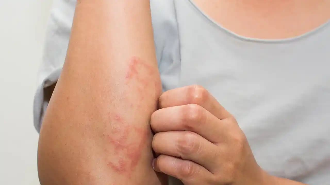 Stres ve Saç Dökülmesi: Kozmetik Çözümler ve Saç Sağlığını Koruma Yöntemleri