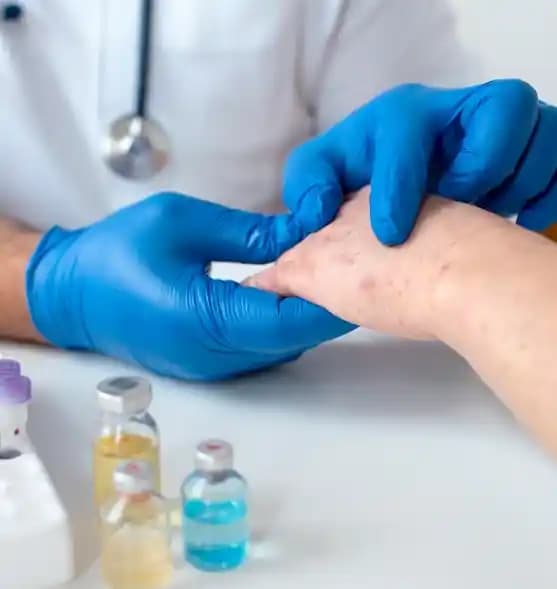 Stresle Bağlantılı Egzama: Kozmetik ve Tedavi Yaklaşımları Analizi