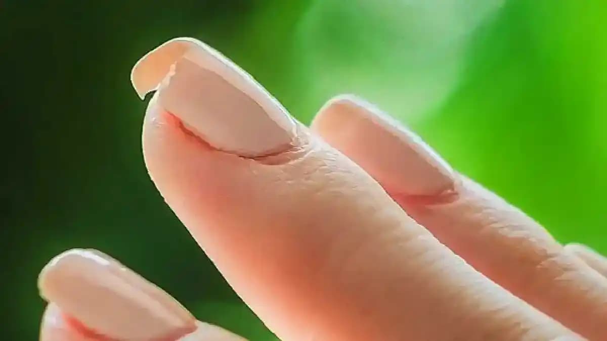 Sürekli Tırnak Kırılmasının Nedenleri ve Etkili Çözüm Yolları