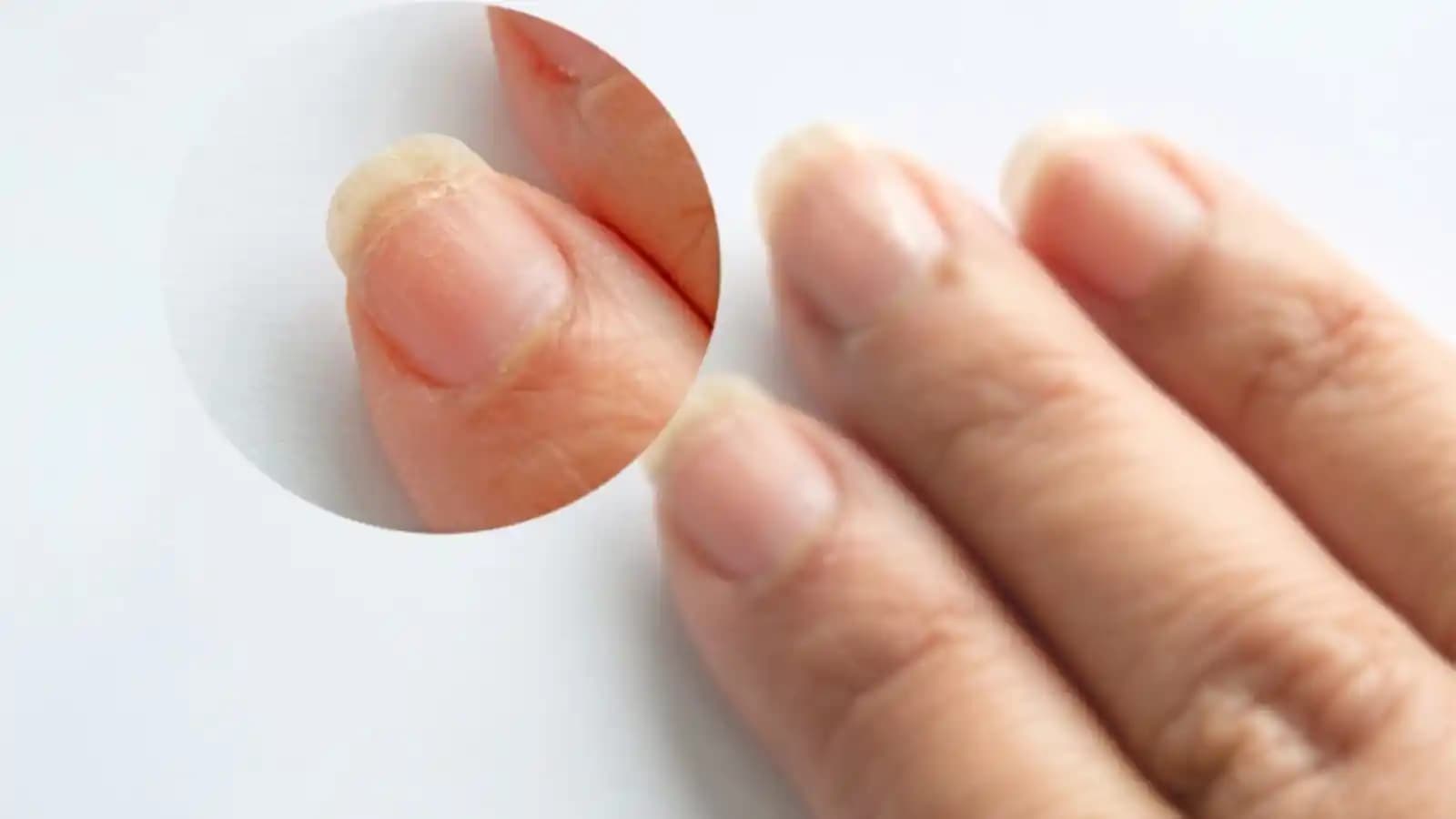 Tırnak Kırılması Nedenleri ve Sağlıklı Tırnaklar İçin Bakım İpuçları