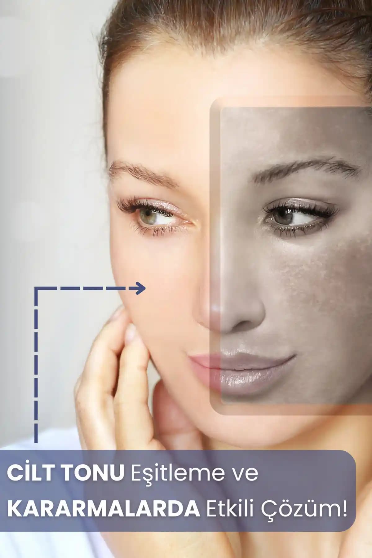 Vücut Leke Tedavisi Yöntemleri ve Modern Teknolojilerle Cilt Sağlığını Koruma