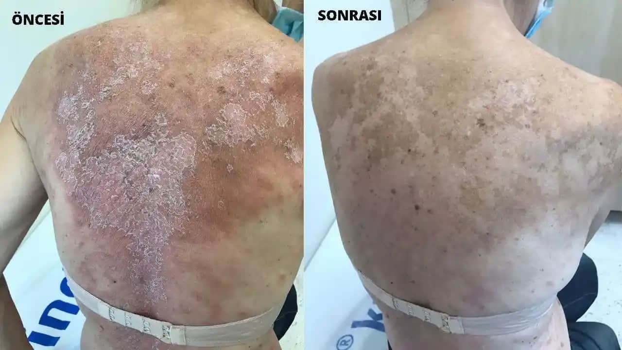 Vücutta Kızarıklık ve Güvenli Kozmetik Çözümler Rehberi