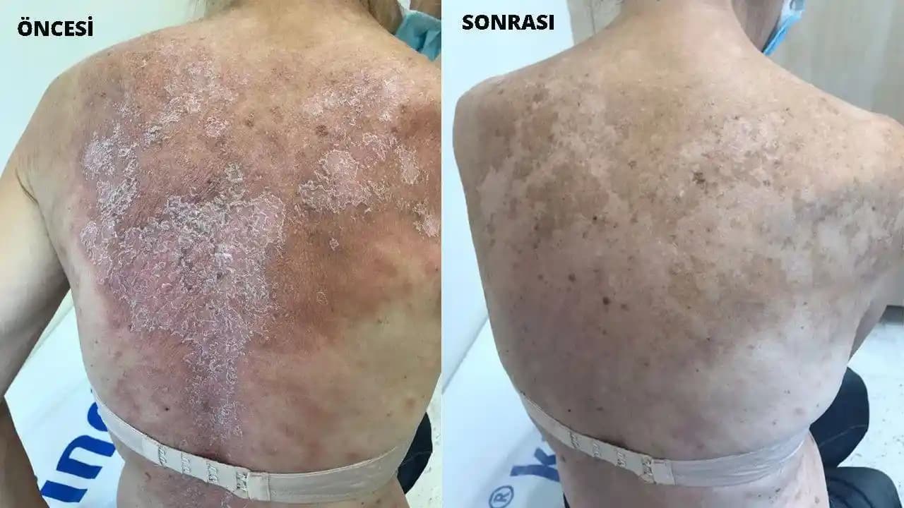 Vücutta Kızarıklık ve Güvenli Kozmetik Çözümler Rehberi