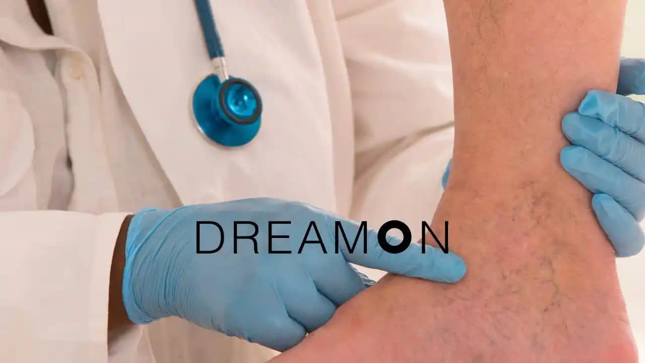 Vücutta Kızarıklıkların Sebepleri ve Çözüm Yolları Hakkında Detaylı Bilgiler