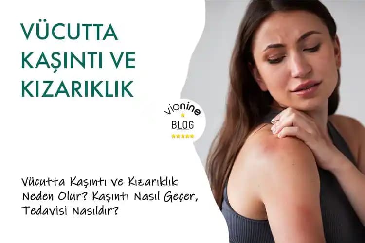Vücutta Nokta Nokta Kızarıklık ve Kaşıntıyı Azaltan Etkili Kozmetik ve Bakım Yöntemleri