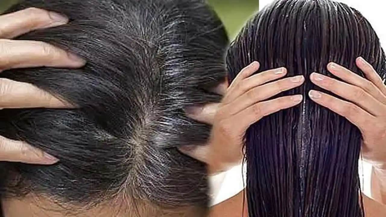 Yağlı Kepek Nasıl Geçer? Etkili Yöntemler ve Bakım İpuçları