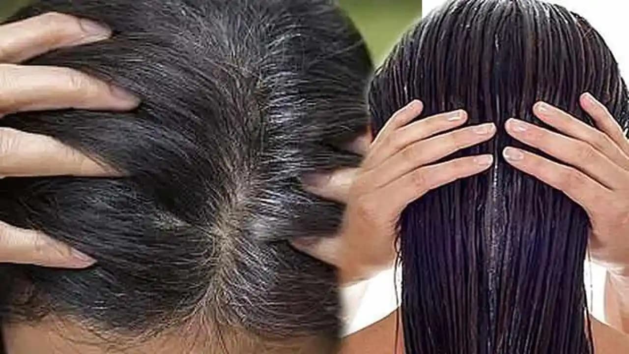 Yağlı Kepek Nasıl Geçer? Etkili Yöntemler ve Bakım İpuçları