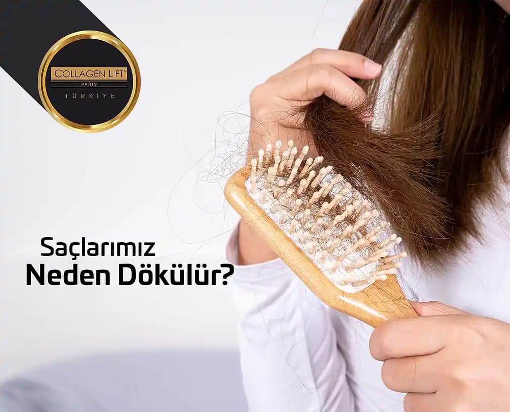 Yağlı Saç Neden Dökülür ve Dökülmeyi Azaltıcı Etkili Yöntemler
